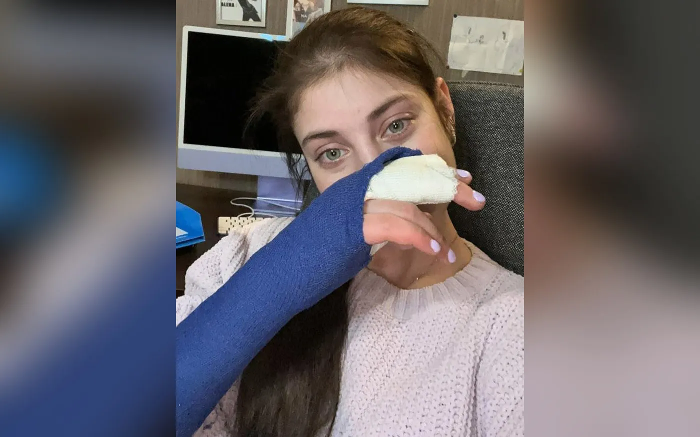 Косторная травмы.webp