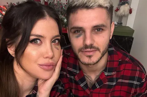 Драка на Рождество? Мауро Икарди и Ванда Нара опубликовали фото с синяками